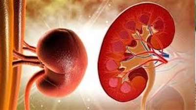علاج الفشل الكلوي بالغسيل والزراعة.. أيهما أفضل للمريض؟