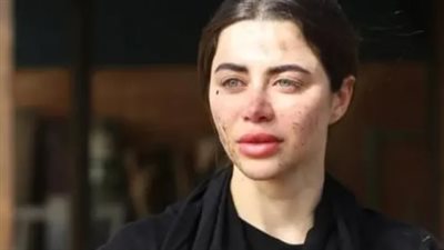 كل ما تريد معرفته عن يارا السكري بطلة مسلسل علي كلاي في رمضان 2026