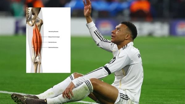 الإصابة تنهي ما تبقى من موسم مبابي وتثير القلق قبل المونديال