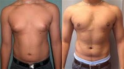 دراسة: تناول مكمل طبيعي يمكن أن يقلل من الدهون الضارة في 