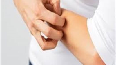 حالة نادرة وغامضة مسببة للحساسية تجاه الماء