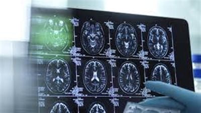 هل المكملات البيولوجية النشطة يمكن أن تكون مفيدة للصحة أو ضارة؟