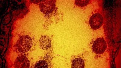  دراسة حديثة تكشف أحد الأعراض الرئيسية لمتحور أوميكرون من فيروس كورونا