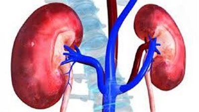 كل ما تريد معرفته حول المتلازمة الكلوية