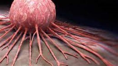 دون تدخل جراحي.. علماء يطورون علاج واعد للسرطان 