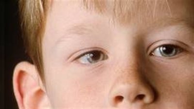 كل ما تريد معرفته حول العين الكسولة