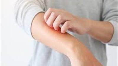 تعرف على أعراض على الجلد للإصابة بأوميكرون