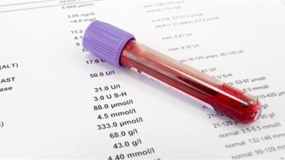 أخصائية تكشف عن كيفية تأثير 