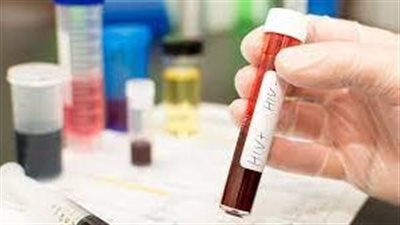 باحثون يحددون متحورة أكثر قوة لفيروس 