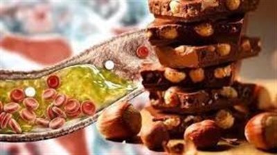 باحثون يؤكدون أن الشوكولاتة فعالة في خفض نسبة كوليسترول الدم