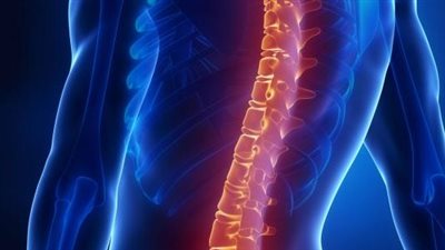  ابتكار دعامة ظهر ذكية لعلاج الحالة المرضية المتمثلة بالانحناء الجانبي للعمود الفقري