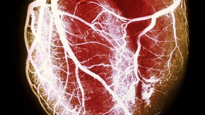 مفاجأة.. قصار القامة أكثر عرضة لأمراض القلب