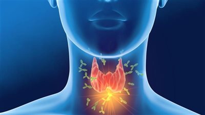 للمسح الذري للغدة الدرقية أهمية كبيرة تعرف عليها
