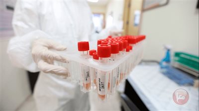 ما مدى إمكانية أن تكون جائحة كورونا في مراحلها النهائية؟