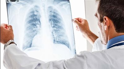 العلامات التي تشير إلى الإصابة بسرطان الرئة