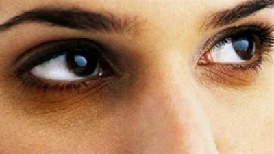 طبيب روسي: العين مرآة الجسم بكامله