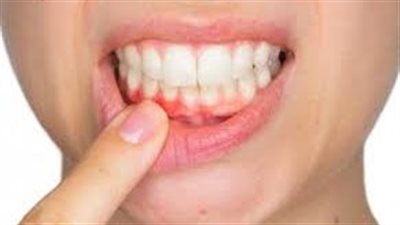  بروتين بشري له فوائد محتملة تتجاوز صحة الفم والأسنان