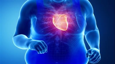  السمنة.. أحد أهمّ العوامل التي تزيد من احتمالية حدوث العديد من الأمراض