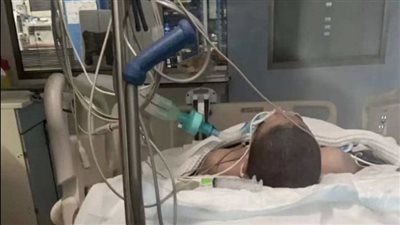  بعد دخوله في غيبوبة.. ما هي آخر تطورات حالة الطفل الكويتي شبل يام؟
