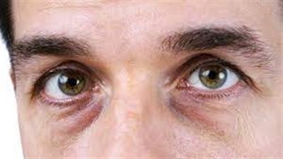 الكونسيلر.. يعد بمثابة عصا سحرية لإخفاء الهالات السوداء