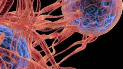 الأعراض الأكثر شيوعا المرتبطة بالسرطان