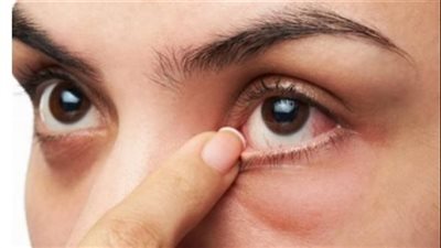 العلامات الشائعة للسرطان التي تظهر في العينين