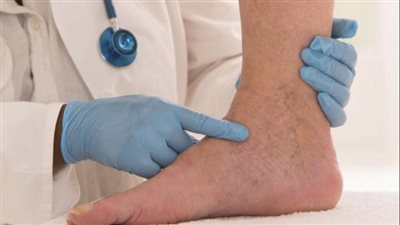 باحثون يحذرون من الجلوس لمدة طويلة: يهددك بجلطة الساق