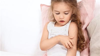 لتخفيف حدة المتاعب.. عليك العناية السليمة ببشرة الطفل المصاب بالإكزيما