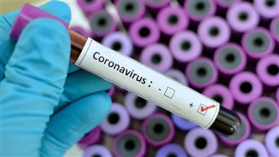 دراسة تكشف عن أعراض كورونا طويلة الأمد 