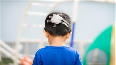 تعرف على أعراض الإصابة بارتجاج في المخ للأطفال