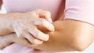 خبيرة تكشف عن أكثر العلامات الجلدية انتشارا عند الإصابة بمتحور 