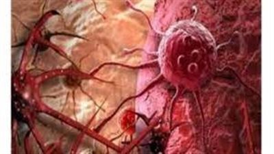  ما أبرز أعراض أمرض السرطان؟