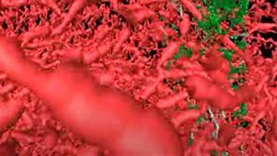 باحثون يطورون تقنية تصوير جديدة تظهر الأوعية الدموية بشكل لم يسبق له مثيل