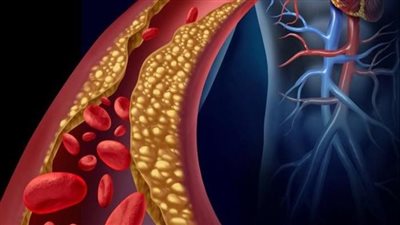 دراسة: طول العمر يتحقق عندما يتم تقليل عدد من المخاطر الصحية الخطيرة