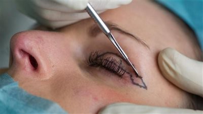  في أي سن يفضل إجراء أول عملية تجميل.. جراح روسي يُجيب