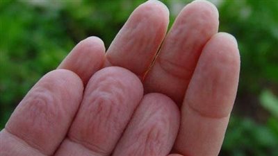 باحثون: أصابع اليد قد تحمل أدلة على الصحة العامة وقد تتنبأ بعدد من العوامل