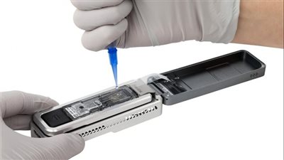 تطوير اختبار جديد للحمض النووي يمكن أن يحدد بدقة مجموعة من الأمراض الوراثية