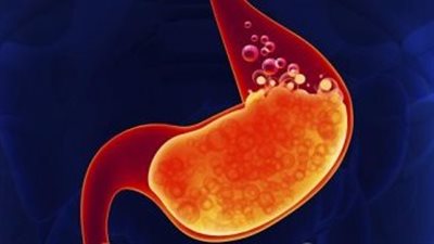 باحثون: سبب فرط الحمضية يتمثل في الإفراط في تناول الأغذية