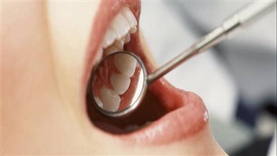  نتائج دراسة جديدة تكشف وجود صلة بين بعض أنواع بكتريا الفم وارتفاع ضغط الدم