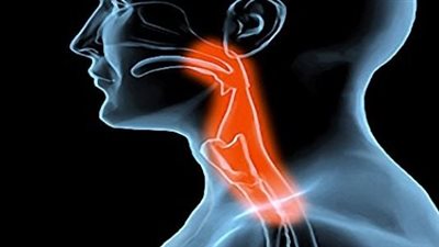 احذر.. العسر المتكرر في بلع الطعام مؤشرًا من أعراض الإصابة بمرض خطير