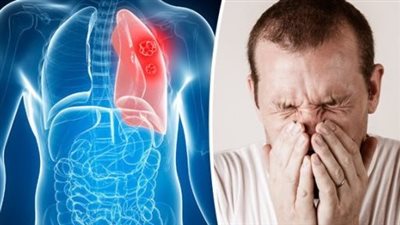 دواء يُعتبر أكبر اختراق علاجي منذ عقود لسرطان الرئة