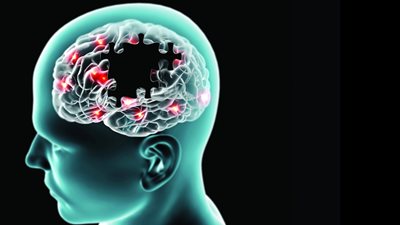 سبب يزيد خطر الإصابة بالجلطة الدماغية