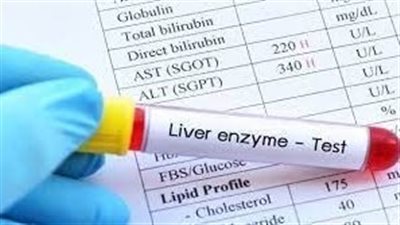  أهمية فحص وظائف الكلى العادية