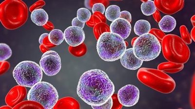 الكشف جزيئا حيويا يمكن أن يساعد على تشخيص الأورام الخبيثة