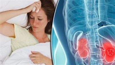 خبيرة تكشف عن النظام الغذائي لمن يعاني من أمراض الكلى