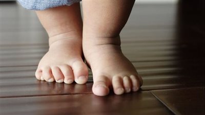 كل ما تريد معرفته حول لين العظام لدى الأطفال