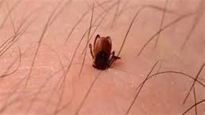 طرق حماية الأطفال من مخاطر لدغة القراد