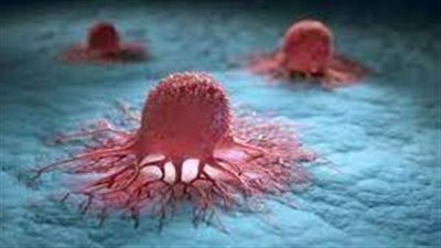 كيف تسبب السمنة السرطان؟