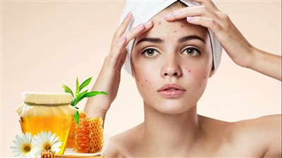 الكشف أطعمة تعمل على حل أكثر مشكلة جلدية شيوعًا في العالم