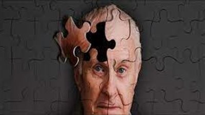  دراسة جديدة: نقص حمض الفوليك، فيتامين ب9ـ يرتبط بضعف الوظيفة الإدراكية 